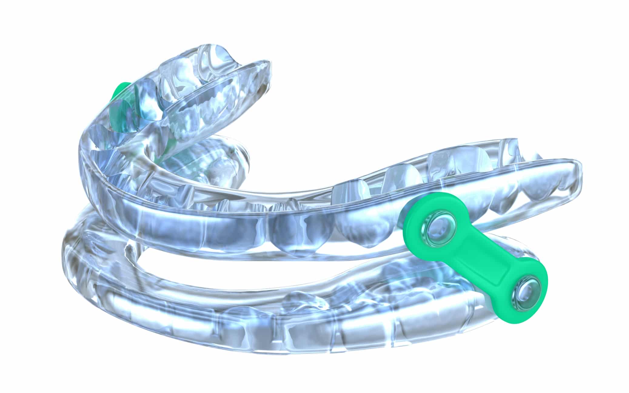 A clear dental device with green adjustment feature, designed for oral use, positioned against a white background.