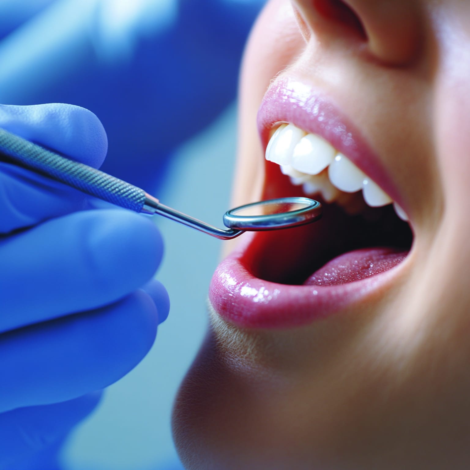 A close-up of a person's open mouth during a dental examination, with a gloved hand holding a dental mirror.